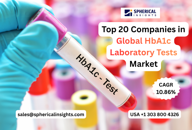 世界のHbA1c検査市場における主要企業トップ20：世界シェア・市場規模・収益レポート（2026～2035年）