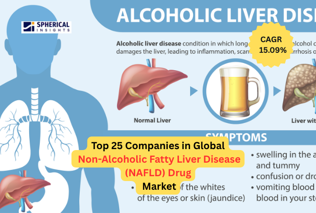 世界の非アルコール性脂肪肝疾患（NAFLD）治療薬市場における主要企業トップ25（2024～2035年）：Spherical Insightsによる分析